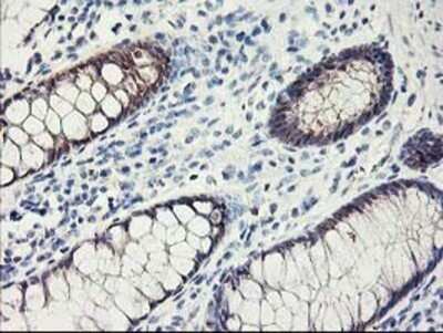 Immunohistochemistry: FABP2/I-FABP Antibody (OTI2C4) - Azide and BSA Free [NBP2-70699] - Staining of paraffin-embedded Human colon tissue using anti-intestinal FABP mouse monoclonal antibody.