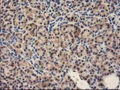 Immunohistochemistry: FABP2/I-FABP Antibody (OTI2C4) - Azide and BSA Free [NBP2-70699] - Staining of paraffin-embedded Human pancreas tissue using anti-intestinal FABP mouse monoclonal antibody.