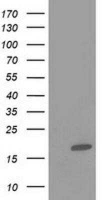 Western Blot: FABP2/I-FABP Antibody (OTI2C4) - Azide and BSA Free [NBP2-70699] - HEK293T cells were transfected with the pCMV6-ENTRY control (Left lane) or pCMV6-ENTRY intestinal FABP (Right lane) cDNA for 48 hrs and lysed. Equivalent amounts of cell lysates (5 ug per lane) were separated by SDS-PAGE and immunoblotted with anti-intest