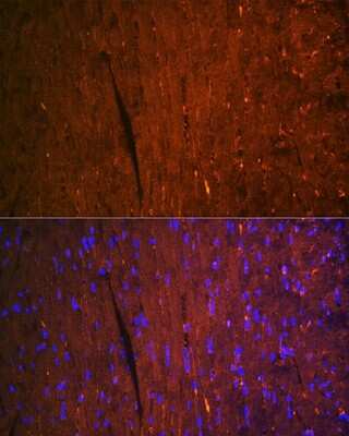 Immunohistochemistry: FABP3/H-FABP Antibody (9B9D7) [NBP3-16508] - Immunofluorescence analysis of mouse heart using FABP3/H-FABP Rabbit mAb (NBP3-16508) at dilution of 1:100 (40x lens). Blue: DAPI for nuclear staining.