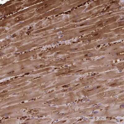 Immunohistochemistry-Paraffin: FABP3/H-FABP Antibody [NBP2-33763] - Staining of human heart muscle shows high expression.