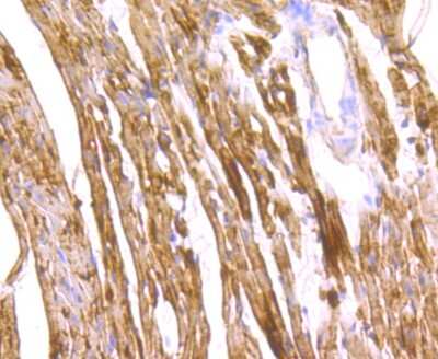 Immunohistochemistry-Paraffin: FABP3/H-FABP Antibody (JU73-03) [NBP2-75485] - Analysis of paraffin-embedded mouse heart tissue using anti- Cardiac FABP3 antibody. Counter stained with hematoxylin.