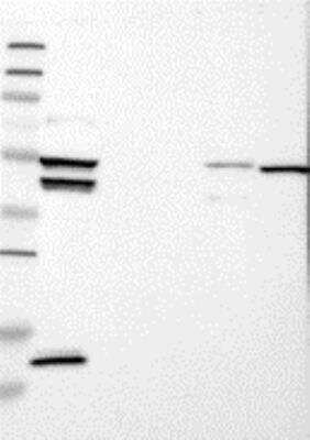 Western Blot: FABP3/H-FABP Antibody [26270002] - Samples:  Lane 1, Marker [kDa]: 250, 130, 95, 72, 55, 36, 28, 17, 11  Lane 2, RT-4 Lane 3, U-251MG sp  Lane 4, Human Plasma  Lane 5, Liver  Lane 6, Tonsil , Target weight [kDa]:  15   Validation score:  2   Validation description:  Supportive - Band of predicted size in kDa (+/-20%) with additional bands present.