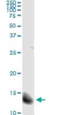 Immunoprecipitation: FABP4/A-FABP Antibody (2H3-1G10) [H00002167-M01] - Analysis of FABP4 transfected lysate using anti-FABP4 monoclonal antibody and Protein A Magnetic Bead, and immunoblotted with FABP4 MaxPab rabbit polyclonal antibody.