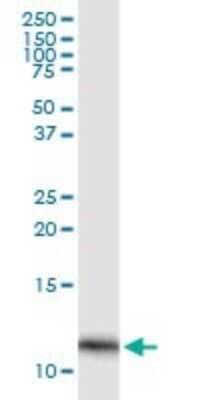Western Blot: FABP4/A-FABP Antibody (2H3-1G10) [H00002167-M01] - FABP4 monoclonal antibody (M01), clone 2H3-1G10. Analysis of FABP4 expression in human pancreas.
