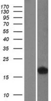 Western Blot: FABP4 Overexpression Lysate (Adult Normal) [NBL1-10420] Left-Empty vector transfected control cell lysate (HEK293 cell lysate); Right -Over-expression Lysate for FABP4.