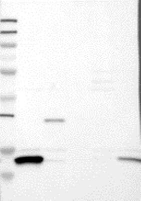 Western Blot: FABP5/E-FABP Antibody [26280002] - Samples:  Lane 1, Marker [kDa]: 250, 130, 95, 72, 55, 36, 28, 17, 11  Lane 2, RT-4  Lane 3, U-251MG sp  Lane 4, Human Plasma  Lane 5, Liver  Lane 6, Tonsil, Target weight [kDa]:  15, 11 (splice variants)   Validation score:  2   Validation description:  Supportive - Band of predicted size in kDa (+/-20%) with additional bands present.