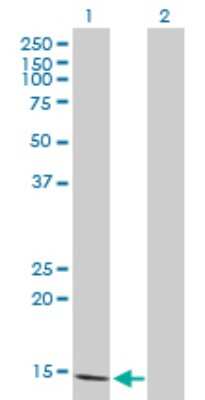 Western Blot: FABP5/E-FABP Antibody [H00002171-B02P] - Analysis of FABP5 expression in transfected 293T cell line by FABP5 polyclonal antibody.  Lane 1: FABP5 transfected lysate(14.85 KDa). Lane 2: Non-transfected lysate.