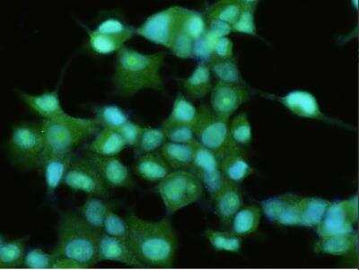 Immunocytochemistry/Immunofluorescence: FABP6 Antibody (201) [NBP2-90127] - Immunofluorescence staining of Human FABP6 in MCF7 cells. Cells were fixed with 4% PFA, permeabilzed with 0.3% Triton X-100 in PBS, blocked with 10% serum, and incubated with rabbit anti-Human FABP6 monoclonal antibody (1:60) at 37? 1 hour. Then cells were stained with the Alexa Fluor(R) 488-conjugated Goat Anti-rabbit IgG secondary antibody (green) and counterstained with DAPI (blue). Positive staining was localized to cytoplasm.