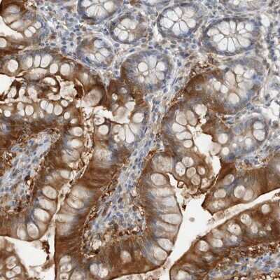 Immunohistochemistry-Paraffin: FABP6 Antibody [NBP1-83129] - Staining of human small intestine shows high expression.