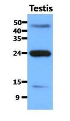 Western Blot: FABP9/T-FABP Antibody (13F9) [NBP2-31200]