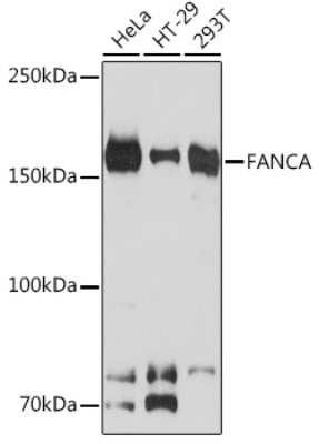 Western Blot: FACA/FANCA Antibody (4Q1Q8) [NBP3-16818] - Western blot analysis of extracts of various cell lines, using FACA/FANCA Rabbit mAb (NBP3-16818) at 1:1000 dilution. Secondary antibody: HRP Goat Anti-Rabbit IgG (H+L) at 1:10000 dilution. Lysates/proteins: 25ug per lane. Blocking buffer: 3% nonfat dry milk in TBST. Detection: ECL Basic Kit. Exposure time: 10s.