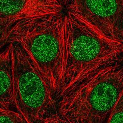 Immunocytochemistry/Immunofluorescence: FACA/FANCA Antibody [NBP2-56898] - Staining of human cell line MCF7 shows localization to nucleus. Antibody staining is shown in green.