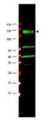 Western Blot: FACA/FANCA Antibody [NBP1-03286] - Anti-FANCA Antibody - Western Blot. Western blot using affinity purified anti-FANCA antibody shows detection of a band at ~133 kD (arrowhead) corres-ponding to FANCA in HeLa whole cell lysates. The identity of the lower molecular weight bands is unknown but may represent breakdown products.