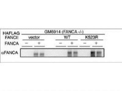 Western Blot: FACA/FANCA Antibody [NBP1-03286] - Anti-FANCA Antibody - Western Blot. Western blot using affinity purified anti-FANCA antibody shows detection of FANCA only in FANCA transfected GM6914 cell lysates. No staining is seen in lysates prepared from FANCA (-/-) cells in the absence of FANCA transfection. Modified from Smogorzewska et al (2007) Cell 129, 289-301.
