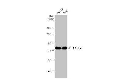 Western Blot: FACL4 Antibody (HL229) [NBP3-13666] - Various whole cell extracts (30 ug) were separated by 7.5% SDS-PAGE, and the membrane was blotted with FACL4 antibody [HL229] (NBP3-13666) diluted at 1:1000. The HRP-conjugated anti-FALSE was used to detect the primary antibody.