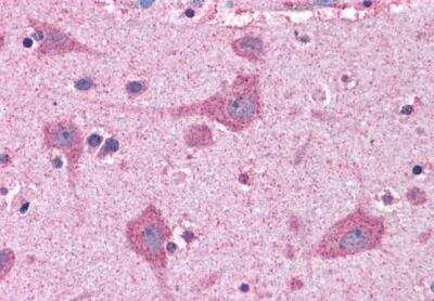 Immunohistochemistry-Paraffin: FACL4 Antibody [NB300-861] - Staining of paraffin embedded Human Cortex. Antibody at 3.75 ug/mL. Steamed antigen retrieval with citrate buffer pH 6, AP-staining.