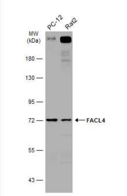 Western Blot: FACL4 Antibody [NBP2-16400] - Various whole cell extracts (30 ug) were separated by 7.5% SDS-PAGE, and the membrane was blotted with FACL4 antibody [N1N3] diluted at 1:1000. The HRP-conjugated anti-rabbit IgG antibody (NBP2-19301) was used to detect the primary antibody.