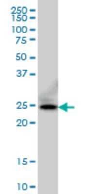 Western Blot: FADD Antibody (3A12) [H00008772-M01] - FADD monoclonal antibody (M01), clone 3A12 Analysis of FADD expression in A-431.