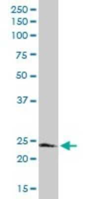 Western Blot: FADD Antibody [H00008772-D01P] - Analysis of FADD expression in human kidney.