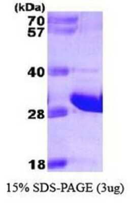 SDS-Page: FADD Protein [NBP1-30266] - FADD, 27.4 kDa (244aa), confirmed by MALDI-TOF  with a purity of 95% by SDS - PAGE