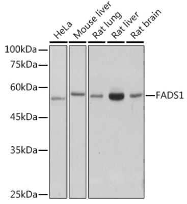 Western Blot: FADS1 Antibody (1M8L2) [NBP3-15253] - Western blot analysis of extracts of various cell lines, using FADS1 antibody (NBP3-15253) at 1:1000 dilution. Secondary antibody: HRP Goat Anti-Rabbit IgG (H+L) at 1:10000 dilution. Lysates/proteins: 25ug per lane. Blocking buffer: 3% nonfat dry milk in TBST. Detection: ECL Basic Kit. Exposure time: 1s.