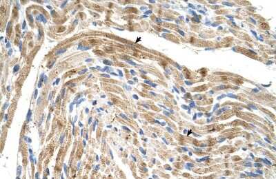 Immunohistochemistry-Paraffin: FADS1 Antibody [NBP1-60085] - Human Muscle Tissue, Skeletal muscle cells (Indicated with Arrows) 4-8ug/ml.