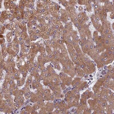 Immunohistochemistry-Paraffin: FADS1 Antibody [NBP1-84312] - Staining of human liver shows moderate cytoplasmic positivity in hepatocytes.