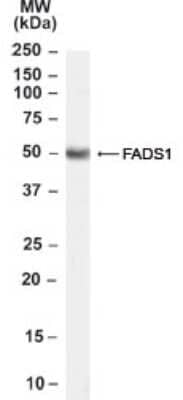 Western Blot: FADS1 Antibody [NB100-57083] - Analysis of FADS1 in human lung lysate (35ug protein in RIPA buffer using this antibody at 0.3 ug/ml.