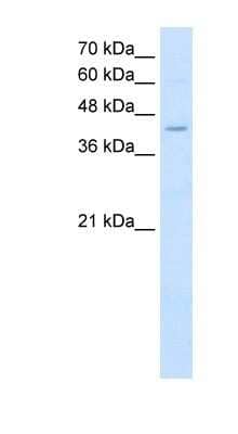 Western Blot: FADS1 Antibody [NBP1-60085] - Titration: 2.5ug/ml Positive Control: K562 cell lysate.