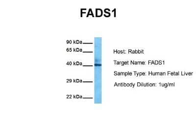 Western Blot: FADS1 Antibody [NBP1-60085] - Sample Tissue: Human Fetal Liver Antibody Dilution: 1.0 ug/ml