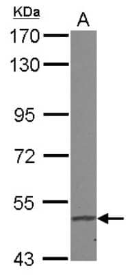 Western Blot: FADS1 Antibody [NBP2-16407] - Sample (30 ug of whole cell lysate) A: A549 7. 5% SDS PAGE gel, diluted at 1:1000.