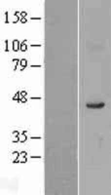 Western Blot: FADS1 Overexpression Lysate (Adult Normal) [NBL1-10425] Left-Empty vector transfected control cell lysate (HEK293 cell lysate); Right -Over-expression Lysate for FADS1.