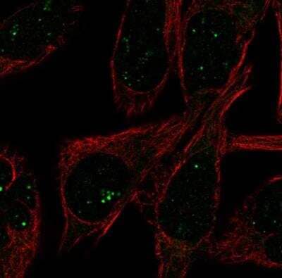 Immunocytochemistry/ Immunofluorescence FADS3 Antibody