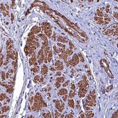 Immunohistochemistry-Paraffin FADS3 Antibody