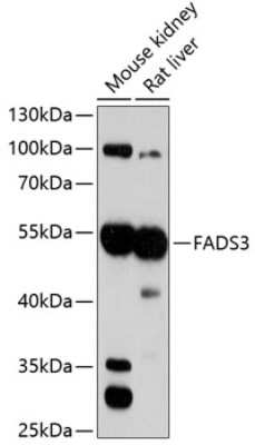 Western Blot: FADS3 Antibody [NBP3-04430] - Analysis of extracts of various cell lines, using FADS3 antibody at 1:3000 dilution. Secondary antibody: HRP Goat Anti-Rabbit IgG (H+L) at 1:10000 dilution. Lysates/proteins: 25ug per lane. Blocking buffer: 3% nonfat dry milk in TBST. Detection: ECL Basic Kit