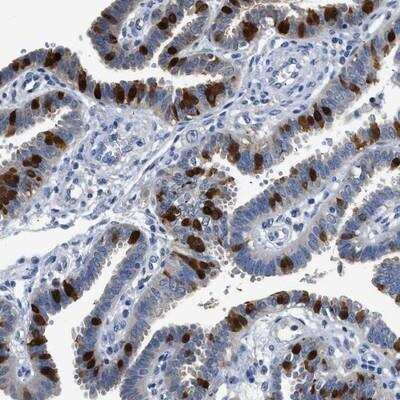 Immunohistochemistry: FADS6 Antibody [NBP2-14490] - Staining of human fallopian tube shows strong cytoplasmic positivity in subset of glandular cells.