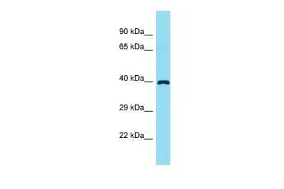 Western Blot: FADS6 Antibody [NBP2-83031] - Host: Rabbit. Target Name: FADS6. Sample Type: Fetal Liver lysates. Antibody Dilution: 1.0ug/ml
