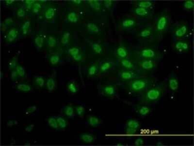 Immunocytochemistry/Immunofluorescence: FAF1 Antibody (1A10) [H00011124-M01] - Analysis of monoclonal antibody to FAF1 on HeLa cell. Antibody concentration 30 ug/ml.