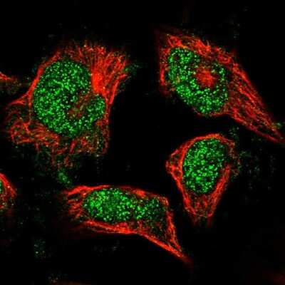 Immunocytochemistry/Immunofluorescence: FAF1 Antibody [NBP1-84527] - Staining of human cell line U-251MG shows positivity in nuclei.