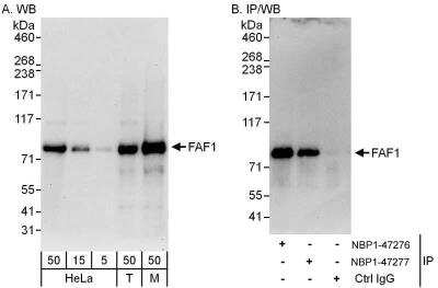 Western Blot: FAF1 Antibody [NBP1-47276] - Samples:  Whole cell lysate from HeLa (5, 15 and 50 ug for WB; 1 mg for IP, 20% of IP loaded), 293T (T; 50 ug), and mouse NIH3T3 (M; 50 ug) cells.   Antibodies: Affinity purified rabbit anti-FAF1 antibody NBP1-47276 used for WB at 0.04 ug/ml (A) and 1 ug/ml (B) and used for IP at 3 ug/mg lysate.  FAF1 was also immunoprecipitated by rabbit anti-FAF1 antibody NBP1-47277, which recognizes a downstream epitope.   Detection: Chemiluminescence with exposure times of 30 seconds (A) and 10 seconds (B).