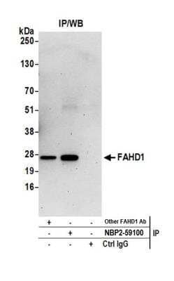 Immunoprecipitation: FAHD1 Antibody [NBP2-59100] - Detection of human FAHD1 by western blot of immunoprecipitates. Samples: Whole cell lysate (0.5 or 1.0 mg per IP reaction; 20% of IP loaded) from 293T cells prepared using NETN lysis buffer. Antibodies: Affinity purified rabbit anti-FAHD1 antibody NBP2-59100 used for IP at 20 ul per reaction. FAHD1 was also immunoprecipitated by another rabbit anti-FAHD1 antibody. For blotting immunoprecipitated FAHD1, NBP2-59100 was used at 1:250. Detection: Chemiluminescence with an exposure time of 75 seconds.