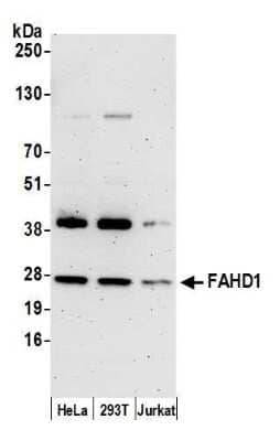 Western Blot: FAHD1 Antibody [NBP2-59100] - Detection of human FAHD1 by western blot. Samples: Whole cell lysate (15 ug) from HeLa, 293T, and Jurkat cells prepared using NETN lysis buffer. Antibody: Affinity purified rabbit anti-FAHD1 antibody NBP2-59100 used for WB at 1:1000. Detection: Chemiluminescence with an exposure time of 3 minutes.