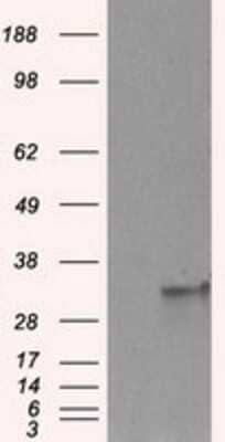 Western Blot FAHD2A Antibody (OTI6D9)
