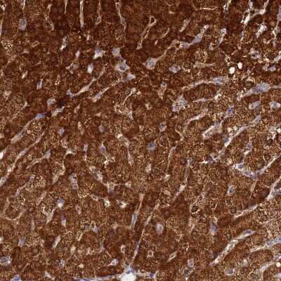 Immunohistochemistry-Paraffin: FAHD2A Antibody [NBP2-54694] - Staining of human liver shows strong cytoplasmic positivity in hepatocytes.