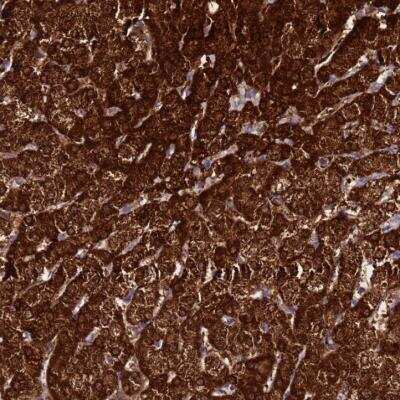 Immunohistochemistry-Paraffin: FAHD2A Antibody [NBP2-54717] - Staining of human liver shows strong cytoplasmic positivity in hepatocytes.