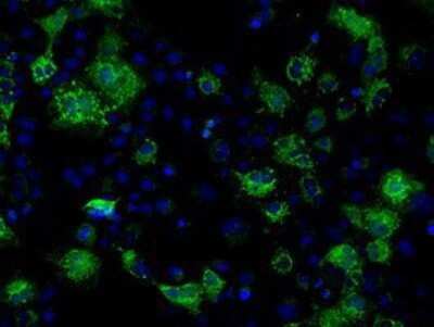 Immunocytochemistry/Immunofluorescence: FAHD2A Antibody (OTI6D9) - Azide and BSA Free [NBP2-71886] - Staining of COS7 cells transiently transfected by pCMV6-ENTRY FAHD2A.