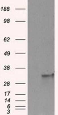 Western Blot: FAHD2A Antibody (OTI6D9) - Azide and BSA Free [NBP2-71886] - HEK293T cells were transfected with the pCMV6-ENTRY control (Left lane) or pCMV6-ENTRY FAHD2A (Right lane) cDNA for 48 hrs and lysed. Equivalent amounts of cell lysates (5 ug per lane) were separated by SDS-PAGE and immunoblotted with anti-FAHD2A.