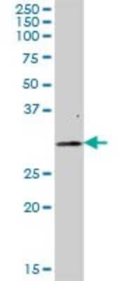 Western Blot: FAHD2A Antibody [H00051011-B01P] - Analysis of FAHD2A expression in human liver.