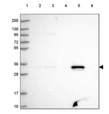 Western Blot FAHD2A Antibody - BSA Free